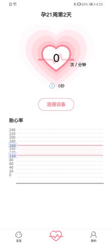 fetalheart胎心仪 1.1.839  1
