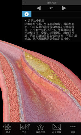 3D生理和病理学 2 安卓版 1