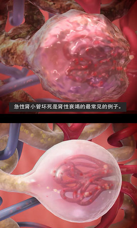 3D生理和病理学 2 安卓版 2