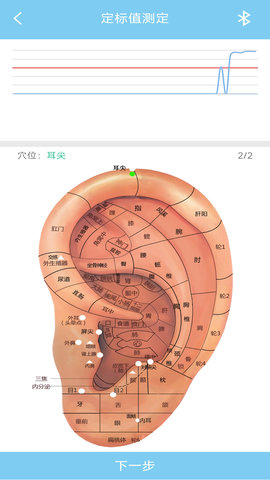 妙郎中耳穴检测 1.7  4