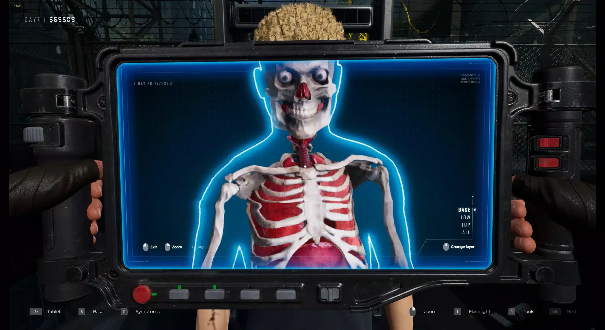 隔离区生存 1.1 安卓版 4